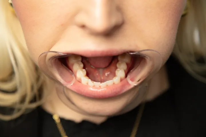 Example photo: lower teeth