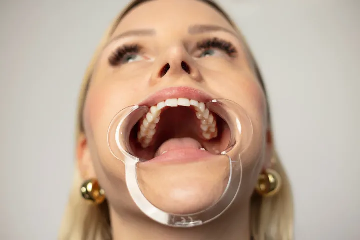 Example photo: upper teeth